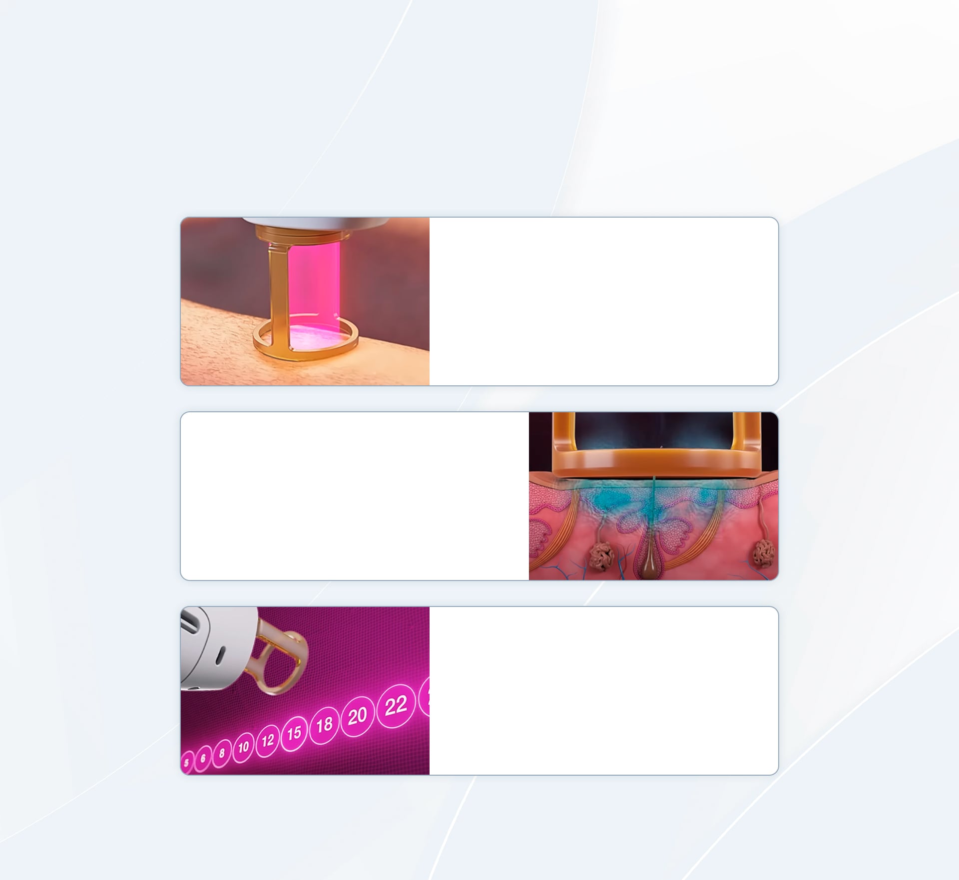 Features of GentleMax Pro Plus