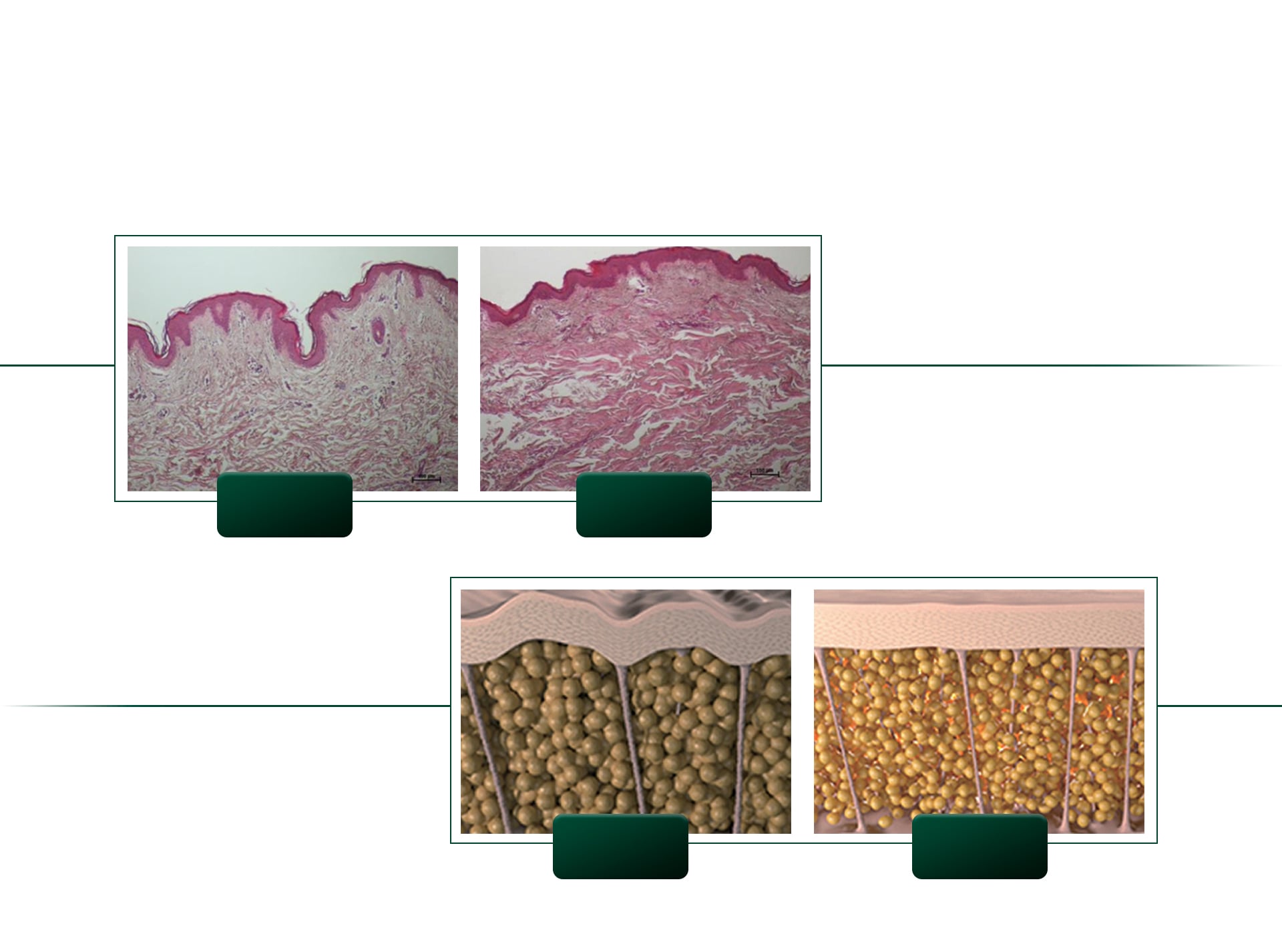 Change in collagen activity