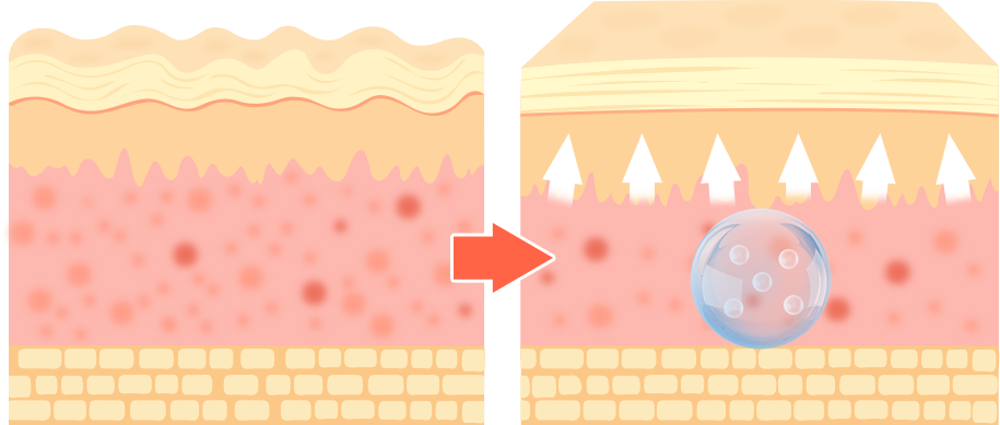 Before and after