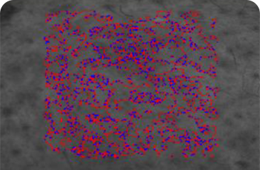 Skin texture density improvement