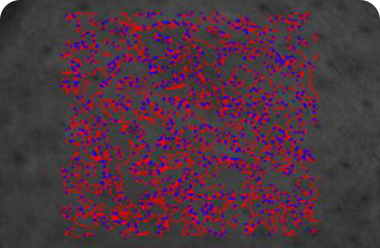 Skin texture density improvement