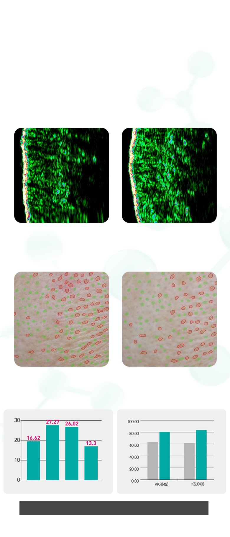 Effects of Rejuran Healer
